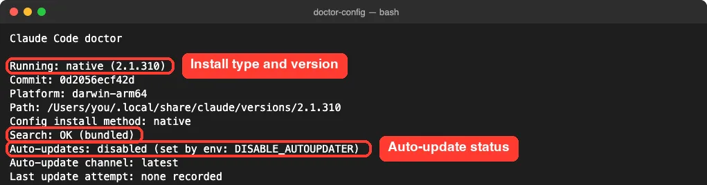 claude doctor output showing native install 2.1.310, Search OK bundled and auto-update status